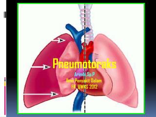 Pneumotoraks Arimbi,Sp.P Ilmu Penyakit Dalam FK UWKS 2012