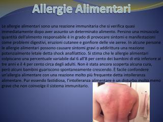 Allergie Alimentari