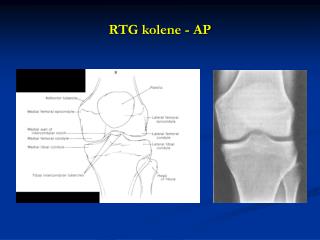 RTG kolene - AP