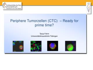 Periphere Tumorzellen (CTC) – Ready for prime time?