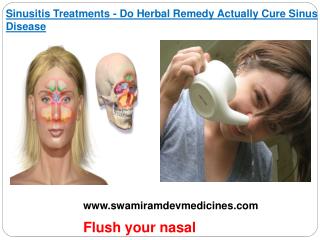 Sinusitis Treatments - Do Herbal Remedy Actually Cure Sinus