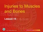 Injuries to Muscles and Bones