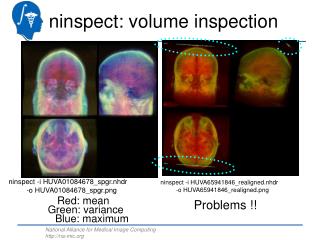 ninspect: volume inspection
