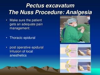 Pectus excavatum The Nuss Procedure: Analgesia