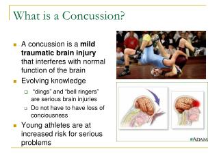 What is a Concussion?