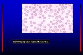 microangiopathic hemolytic anemia