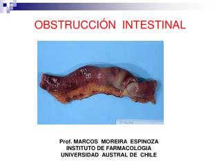 OBSTRUCCIÓN INTESTINAL