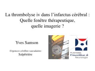 La thrombolyse iv dans l’infarctus cérébral : Quelle fenêtre thérapeutique, quelle imagerie ?