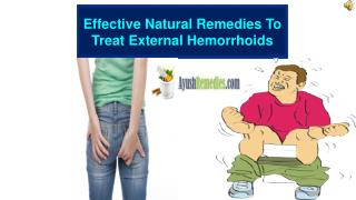 Effective Natural Remedies To Treat External Hemorrhoids