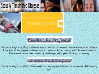 Bacterial Vaginosis (BV) is the most common vaginal infection in women of childbearing age.