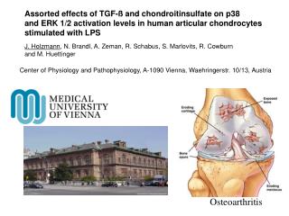 Osteoarthritis