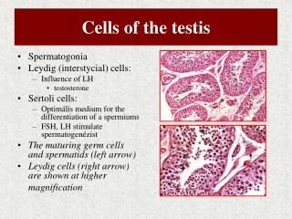 PPT - Torsion of the testis or of the spermatic cord PowerPoint ...