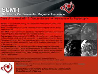 Case of the week 08-15: Danon disease - A rare cause of LV hypertrophy