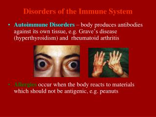 Disorders of the Immune System