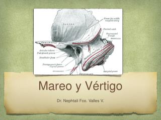 Mareo y Vértigo