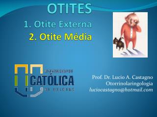 OTITES 1. Otite Externa 2. Otite Média