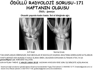 ÖDÜLLÜ RADYOLOJİ SORUSU-171 HAFTANIN OLGUSU ÖDÜL: Şemsiye