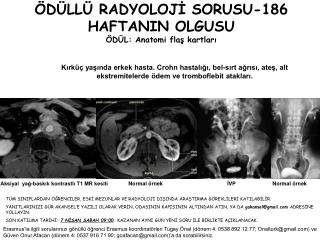 ÖDÜLLÜ RADYOLOJİ SORUSU-186 HAFTANIN OLGUSU ÖDÜL: Anatomi flaş kartları