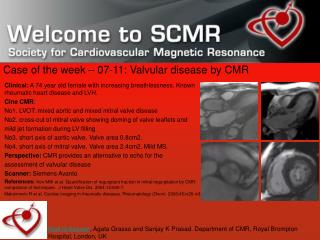 Case of the week – 07-11: Valvular disease by CMR