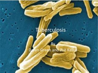 Tuberculosis