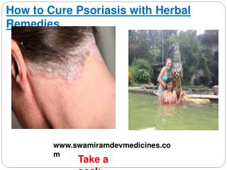 How to Cure Psoriasis with Herbal Remedies