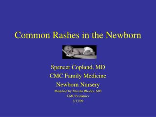 Common Rashes in the Newborn