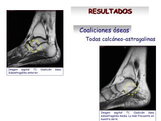 RESULTADOS