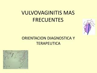 VULVOVAGINITIS MAS FRECUENTES