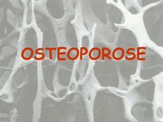 OSTEOPOROSE