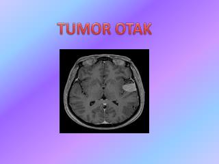 TUMOR OTAK