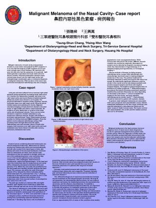 Malignant Melanoma of the Nasal Cavity- Case report 鼻腔內惡性黑色素瘤 - 病例報告