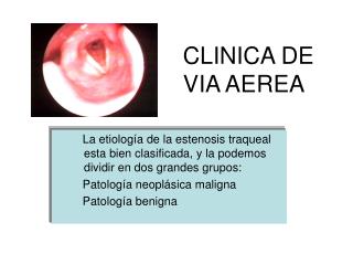 CLINICA DE VIA AEREA