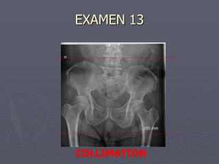 EXAMEN 13