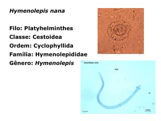 Hymenolepis nana Filo: Platyhelminthes Classe: Cestoidea Ordem: Cyclophyllida