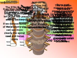 STALIF Animation