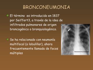 BRONCONEUMONIA