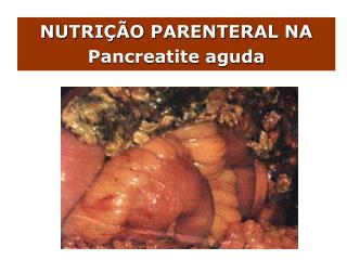 NUTRIÇÃO PARENTERAL NA Pancreatite aguda