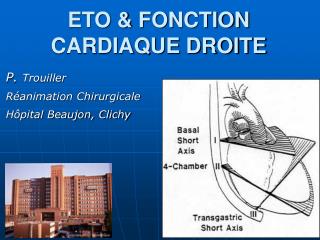 ETO &amp; FONCTION CARDIAQUE DROITE