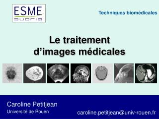 Le traitement d’images médicales