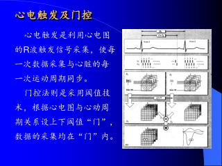 心电触发及门控