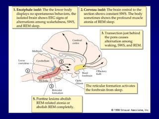Encephale isolé : 	sezione più caudale: tra bulbo e midollo spinale