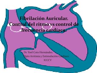 Fibrilación Auricular. Control del ritmo vs control de frecuencia cardíaca.