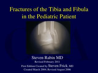 Fractures of the Tibia and Fibula in the Pediatric Patient