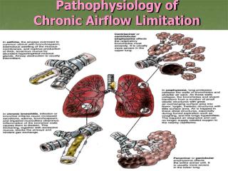 Pathophysiology of Chronic Airflow Limitation