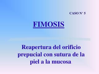 FIMOSIS