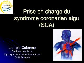 Prise en charge du syndrome coronarien aigu (SCA)