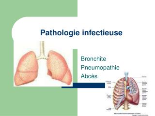 Pathologie infectieuse