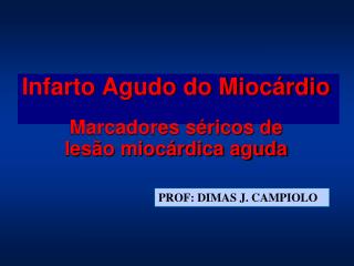 Infarto Agudo do Miocárdio Marcadores séricos de lesão miocárdica aguda