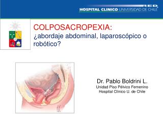 COLPOSACROPEXIA: ¿abordaje abdominal, laparoscópico o robótico?