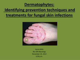 Dermatophytes : Identifying prevention techniques and treatments for fungal skin infections